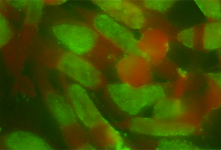 Psittacosis images