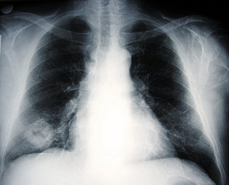 com.bmj.content.model.Caption@133e4bf1