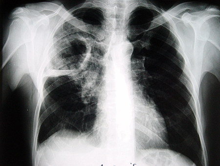 com.bmj.content.model.Caption@278ae000