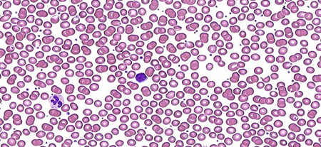 com.bmj.content.model.assessment.Caption@44e0e1f6