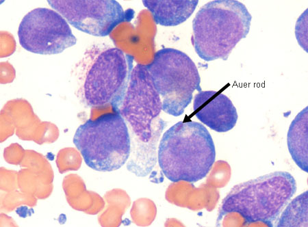 com.bmj.content.model.assessment.Caption@4d605f78