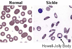 com.bmj.content.model.assessment.Caption@5a0f945d