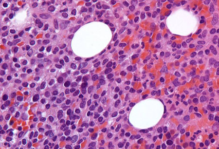 com.bmj.content.model.assessment.Caption@2af0110c