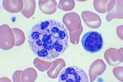 com.bmj.content.model.assessment.Caption@51e3398d