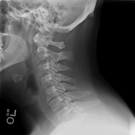 com.bmj.content.model.assessment.Caption@34341ce4