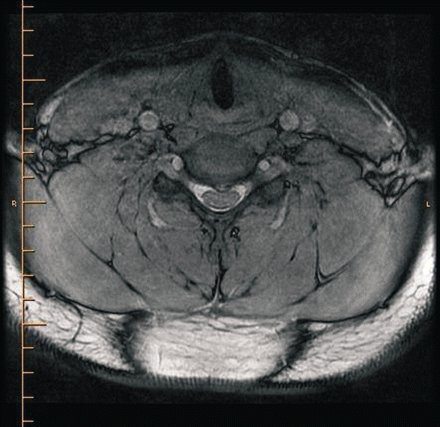 com.bmj.content.model.assessment.Caption@7467d13f