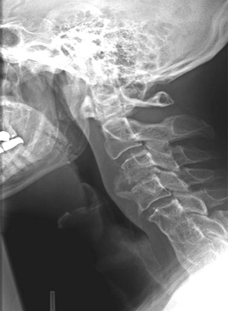 com.bmj.content.model.assessment.Caption@66a678ee