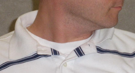 Avaliação da dor cervical images
