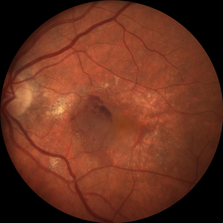 com.bmj.content.model.assessment.Caption@3feb084d