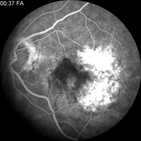 com.bmj.content.model.assessment.Caption@57f03a29
