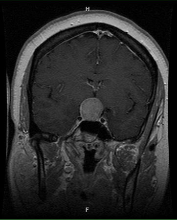 com.bmj.content.model.assessment.Caption@5b4d444f