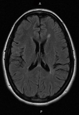 com.bmj.content.model.assessment.Caption@297f7089