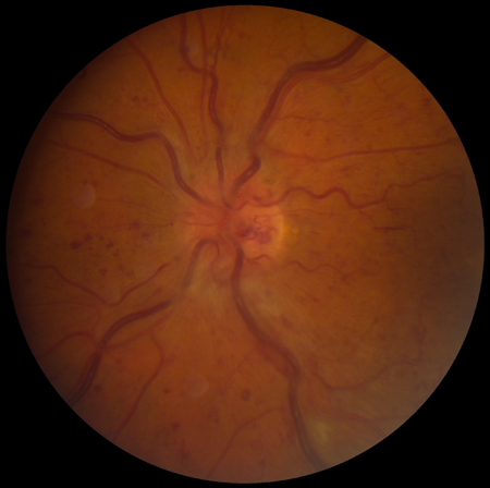 com.bmj.content.model.assessment.Caption@23d88b70