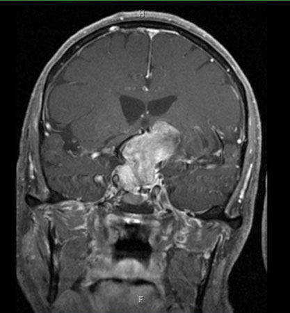 com.bmj.content.model.assessment.Caption@2f961cf4