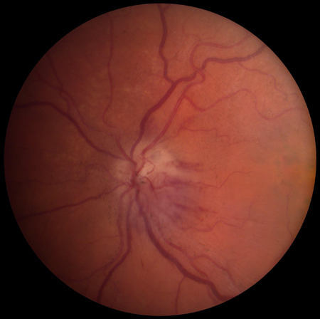 com.bmj.content.model.assessment.Caption@c3c3a8d