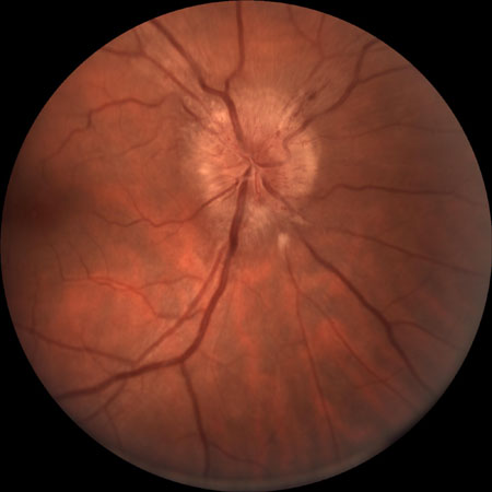com.bmj.content.model.assessment.Caption@5e0f01e1