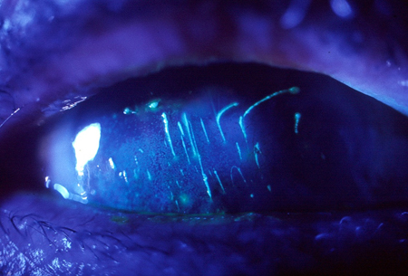 com.bmj.content.model.Caption@13385d2d