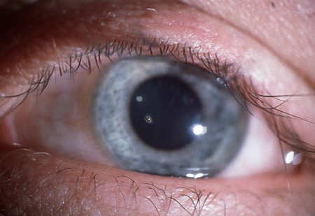 com.bmj.content.model.Caption@72f8206c