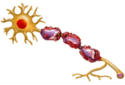 Mild traumatic brain injury images