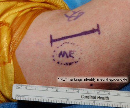 com.bmj.content.model.Caption@1667dfe