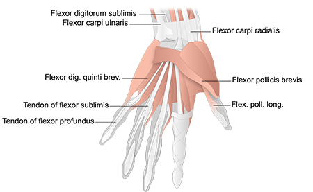 Tenosynovitis of the hand and wrist images
