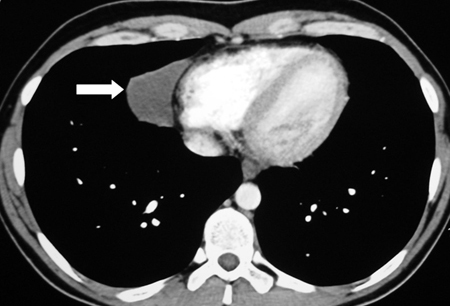 Assessment of mediastinal mass images