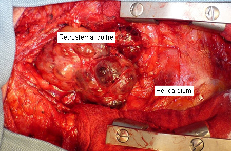 com.bmj.content.model.assessment.Caption@a26719a