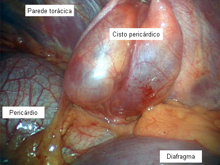 com.bmj.content.model.assessment.Caption@2003b6f5