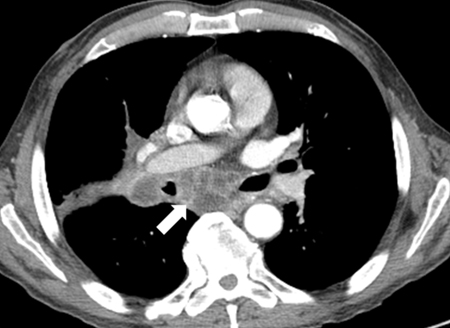 com.bmj.content.model.assessment.Caption@3f6589dc