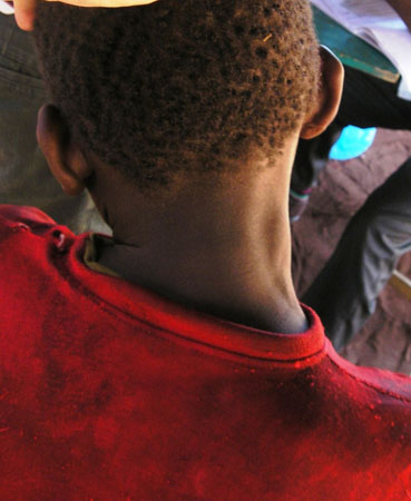 com.bmj.content.model.Caption@613f7b88