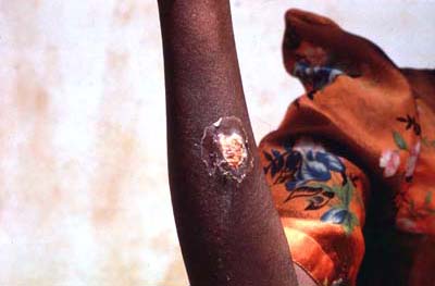 com.bmj.content.model.Caption@823d23b