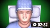 Inserção de um tampão nasal anterior