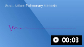 Estenose pulmonar